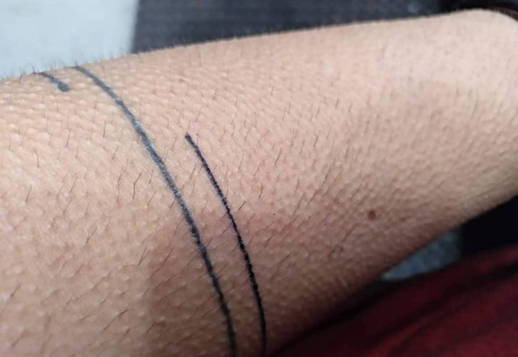 stick and poke tattoo line